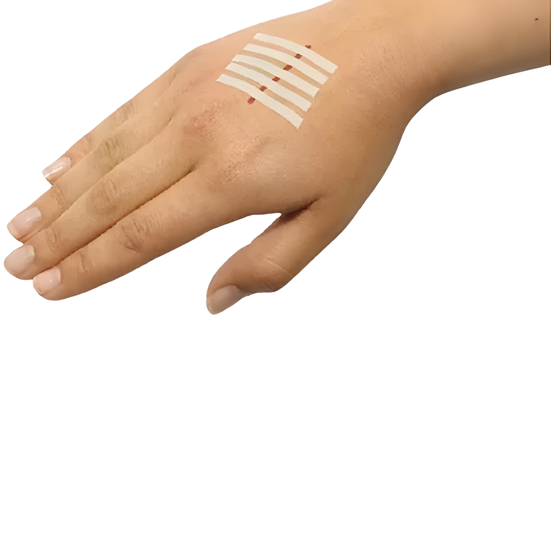 SISTEMA SUTURA E CURATIVO CX C/12UNID  SK...